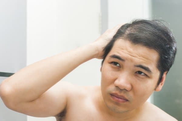Man considers PRP for hair growth