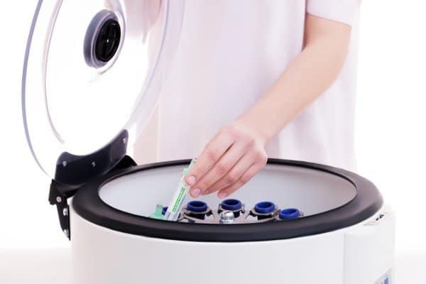 Platelet rich plasma preparation methods