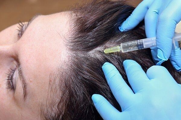 prp injections for hair growth